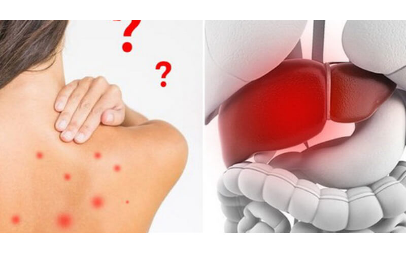 Nóng trong người dẫn đến rất nhiều tác hại cho cơ thể