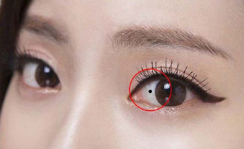 Nốt ruồi bên trong mắt phải bật mí rất nhiều ý nghĩa về tướng số, hậu vận