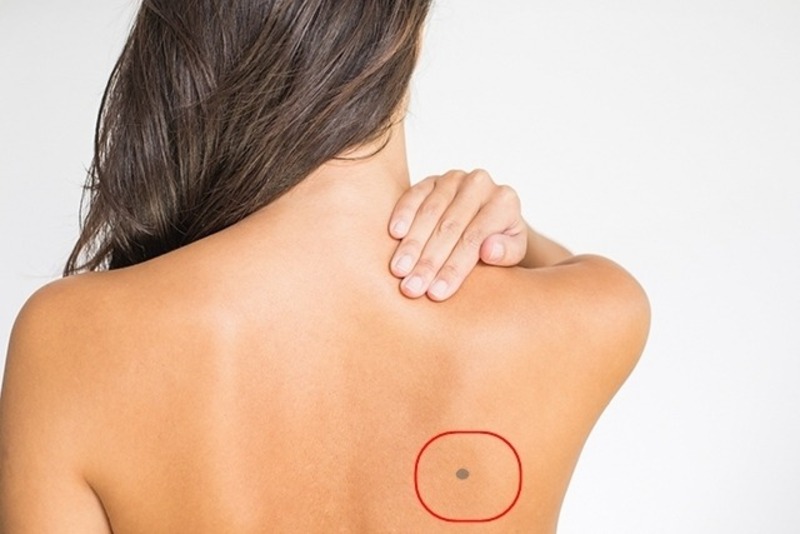 Ý nghĩa của nốt ruồi sau lưng bên phải
