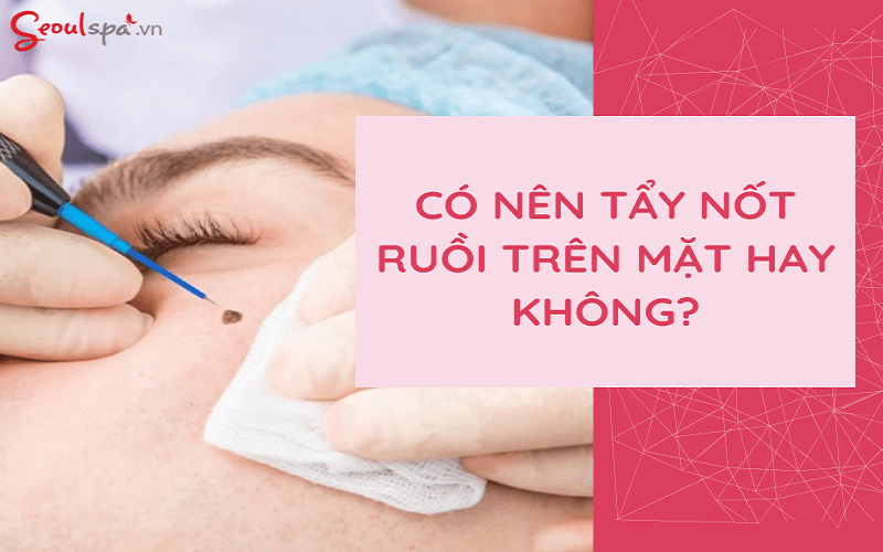 Seoul Spa cung cấp dịch vụ xóa nốt ruồi uy tín hàng đầu