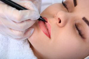Xóa phun môi bằng công nghệ laser hiện đại