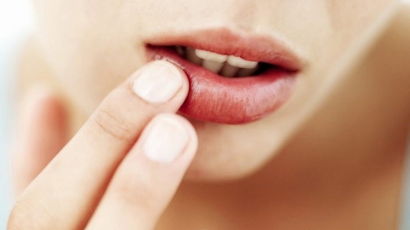 Sau khi xóa xăm, cần chăm sóc môi theo hướng dẫn của bác sĩ