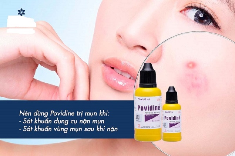 Sử dụng Povidine để sát khuẩn dụng nặn mụn sẽ diệt khuẩn, và ngăn ngừa mụn sưng viêm