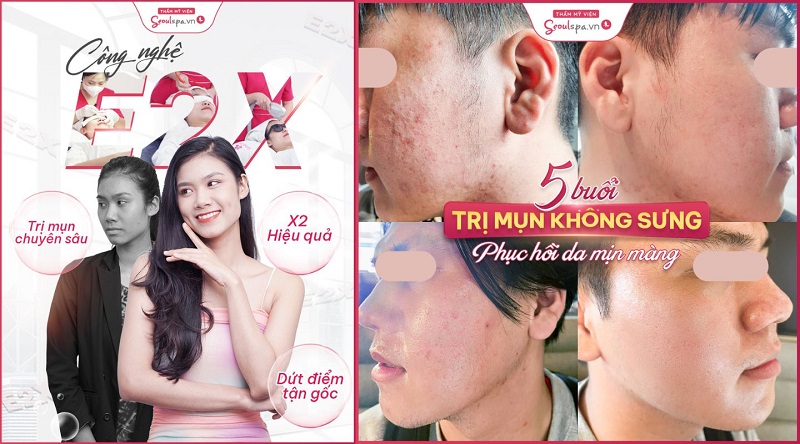 Top 20+ Tham My Vien O Di An Binh Duong Seoul Spa Dĩ An Khai Trương - Ưu Đãi Đồng Giá 199K Dịch Vụ Làm Đẹp 23 Nhiều dịch vụ làm đẹp, độ an toàn cao và hiệu quả vượt trội