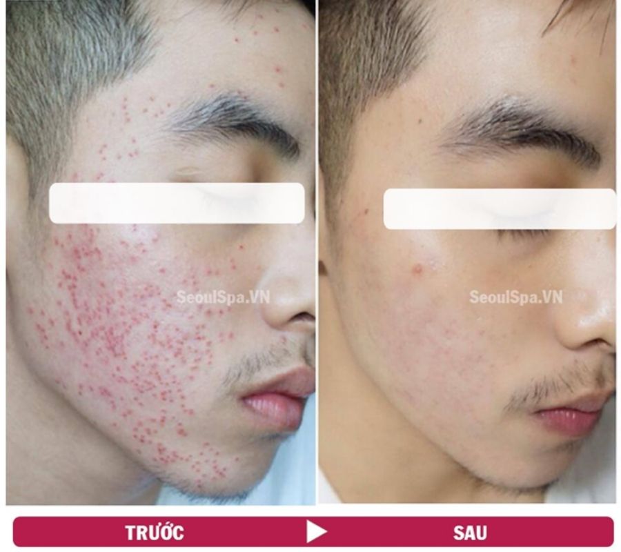 Làn da được phục hồi trắng mịn và tươi tắn hơn