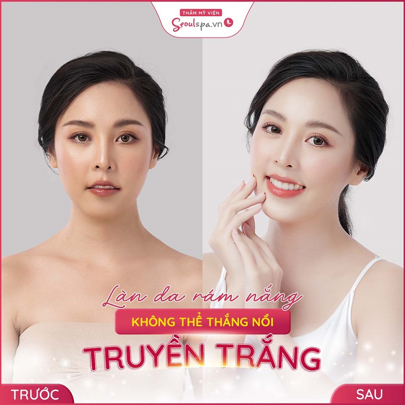 Hiệu quả vượt trội sau khi sử dụng dịch vụ tại Seoul Spa