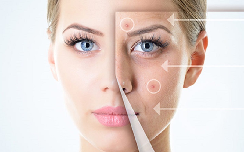 Đến Spa để điều trị các bệnh lý về da hiệu quả và an toàn hơn tại nhà
