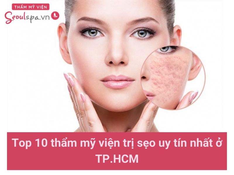 Những thẩm mỹ viện trị sẹo uy tín nhất tại TP.HCM
