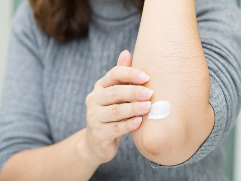 Điều trị các vết da tổn thương với thuốc Glomazin Neo