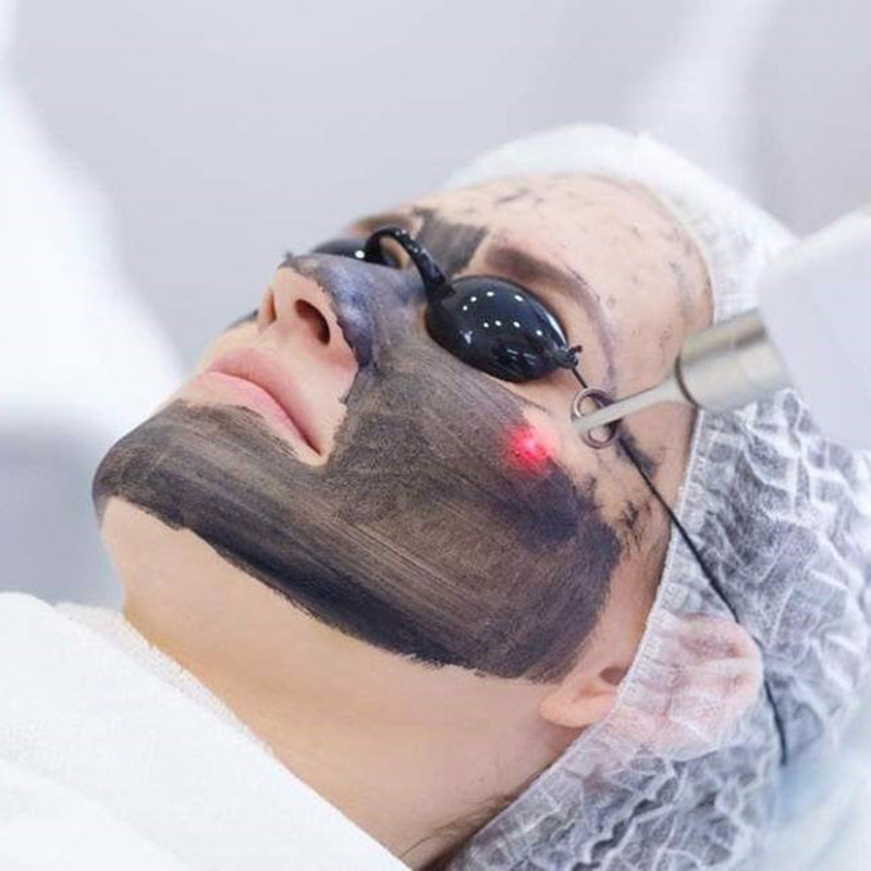 Thực hiện bắn tia laser lên mặt nạ than hoạt tính