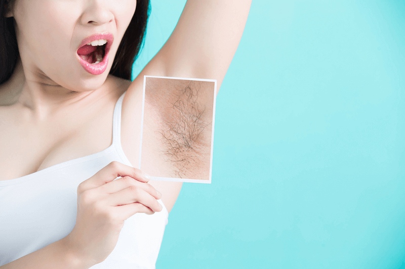 Top 20+ Cách Trị Thâm Nách Tại Nhà Bằng Kem Đánh Răng Trị hôi nách bằng kem đánh răng có tốt? TOP 6 cách hiệu quả 44 Sau khi tẩy lông nách bằng kem đánh răng thì lông có thể sẽ mọc nhanh, dày và rậm hơn