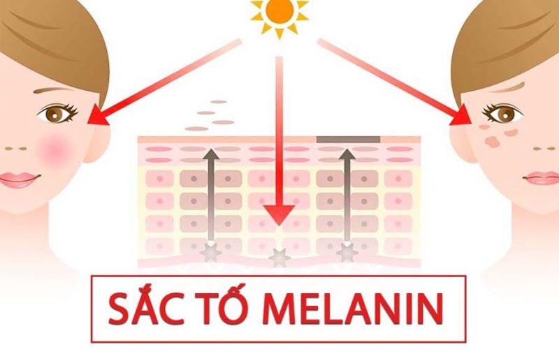 Thâm mụn là do tăng sắc tố melanin