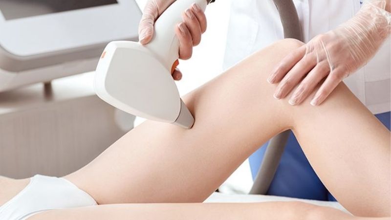 Công nghệ triệt lông Diode Laser được các chuyên gia đánh giá cao