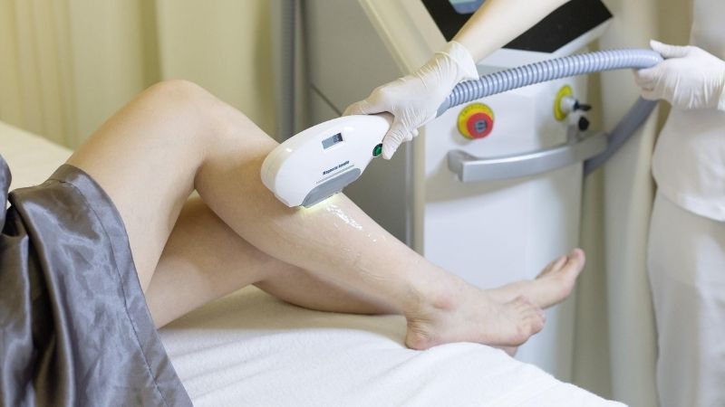Triệt lông tại spa mang lại hiệu quả loại bỏ tận gốc các nang lông
