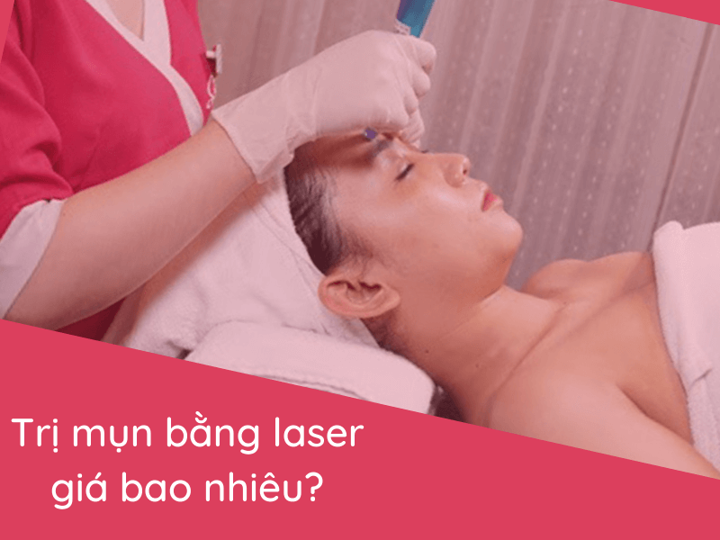 Trị mụn bằng laser bao nhiêu tiền? Giá trị mụn bằng laser ...