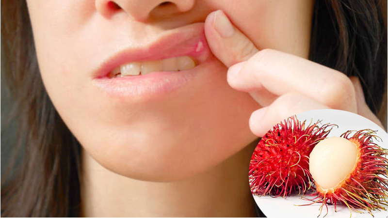 Gây ảnh hưởng không tốt khi ăn chôm chôm nhiều
