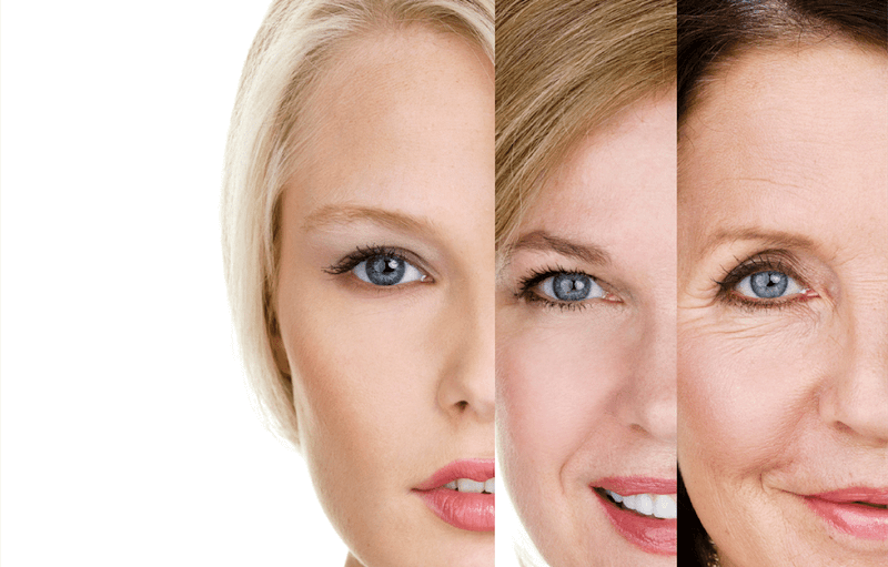 Trẻ hóa da Thermage vùng mặt
