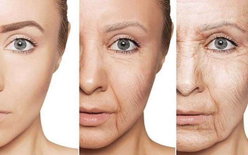 Những làn da và đối tượng cần thực hiện Ultherapy