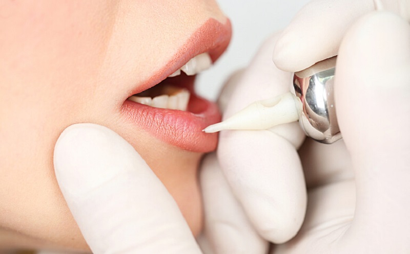 Top 20+ Cách Làm Môi Hết Sưng Sau Phun Xăm môi bị sưng phải làm sao? Cách khắc phục hiệu quả nhất 32 Công nghệ xăm môi tiên tiến hoặc lỗi thời sẽ ảnh hưởng đến kết quả sau khi xăm