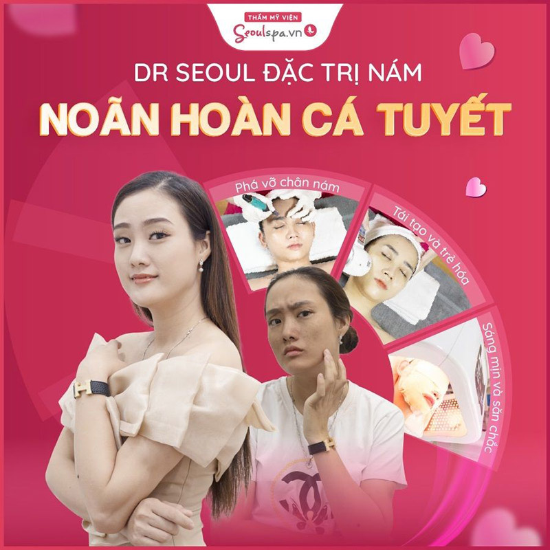 Noãn hoàn cá tuyết 4.0 giúp bạn có được làn da trắng sáng không còn nám
