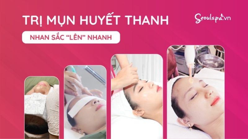 Đánh tan mụn tại Seoul Spa bằng dịch vụ trị mụn huyết thanh