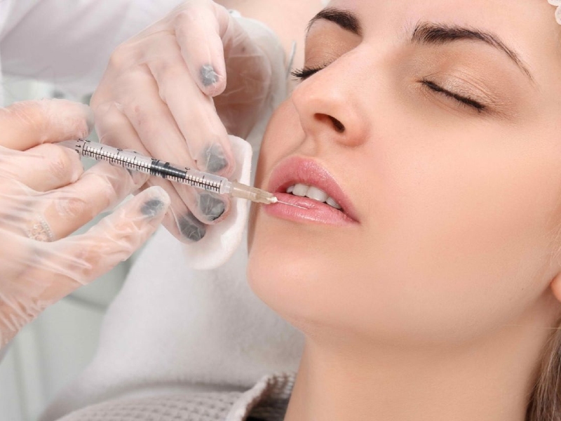 Tiêm filler môi là phương pháp làm đẹp hiệu quả, giúp mang đến đôi môi căng mọng và thu hút cho phái đẹp