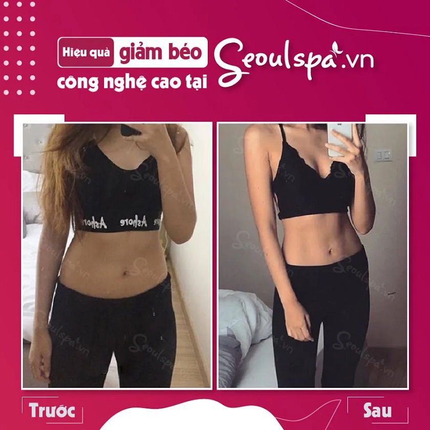 Cách giảm mỡ bụng an toàn hiệu quả tại SeoulSpa.Vn