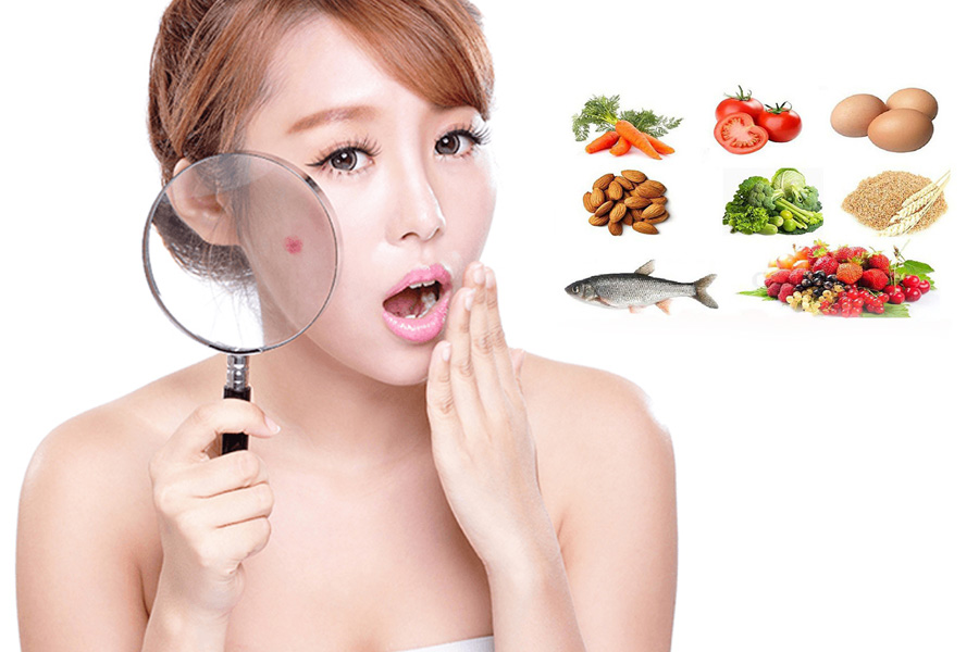 Vì sao ăn uống lại quan trọng trong việc trị thâm mụn?