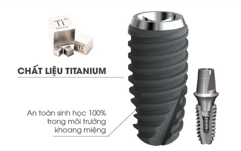 Chất liệu cao cấp Titanium là một trong những yếu tố khiến giá trồng răng Implant ở mức cao