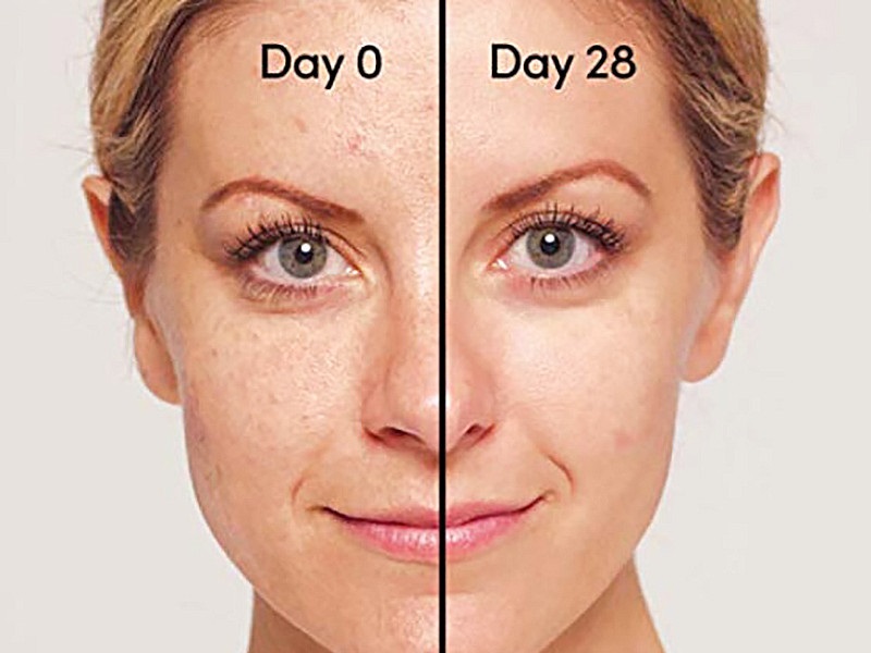 Sự thay đổi của da sau gần 1 tháng sử dụng Retinol