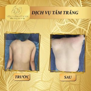 Viện Thẩm Mỹ SOFIA tắm trắng hiệu quả rõ rệt