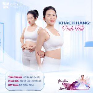 Feedback từ khách hàng sau khi giảm béo bụng tại Seoul Center