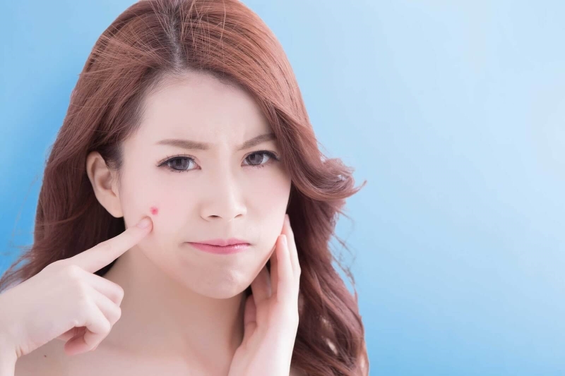 Chỉ nên loại bỏ mụn bọc khi đã khô cồi để tránh lan rộng đến các vùng da khác