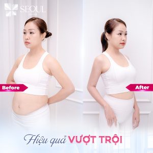 Thẩm mỹ viện Seoul Center cam kết dịch vụ làm đẹp uy tín