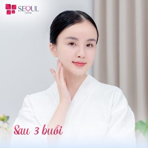 Hiệu quả trị mụn sẽ thể hiện rõ rệt chỉ sau buổi điều trị thứ 3 tại Seoul Center