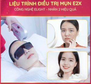 Khách hàng cảm nhận sự thay đổi của làn da sau khi điều trị tại SeoulSpa.Vn