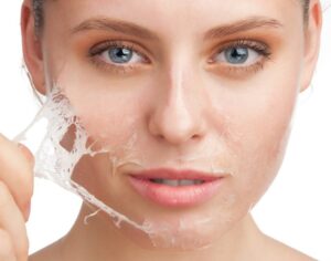 Cách dưỡng da đúng cách sau khi lột để da hồi phục nhanh