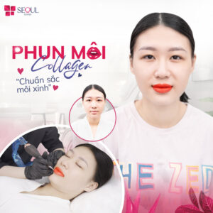 Seoul Center là một trong các địa chỉ phun xăm thẩm mỹ Thủ Đức có dịch vụ chất lượng