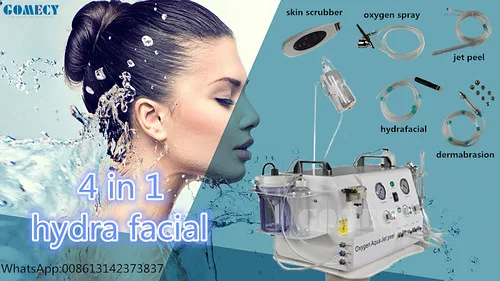 mụn đầu trắng có nên nặn không — featured image