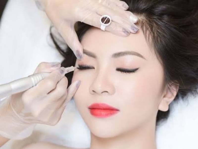 Xóa sửa mí mắt xăm loang: Phương pháp laser & kỳ vọng thực tế