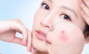 Nên uống kẽm bao nhiêu mg mỗi ngày?