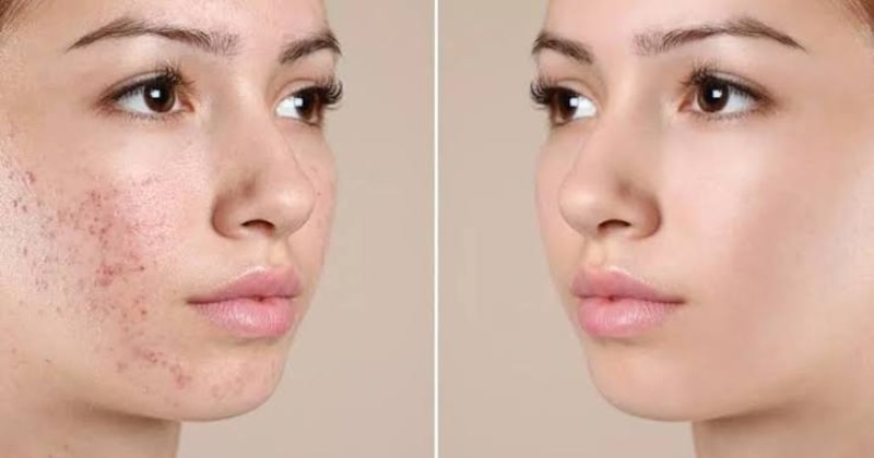 Serum Obagi Vitamin C20 là gì?