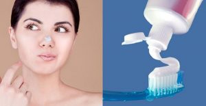 Bạn có thể tận dụng kem đánh răng để tiêu diệt mụn đầu đen