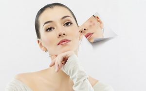 Những địa chỉ spa trị mụn uy tín và chất lượng tại Hà Nam