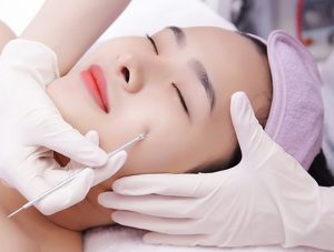Vì sao nên đến spa lấy mụn thay vì tự nặn tại nhà?