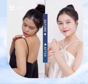 Kết quả tắm trắng vượt trội khi sử dụng dịch vụ tại Seoul Center