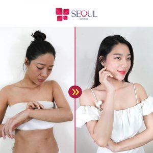 Seoul Center sẽ cung cấp các liệu trình tắm trắng an toàn và hiệu quả nhanh chóng