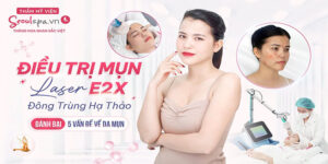 Điều trị mụn công nghệ cao hiệu quả, an toàn tại SeoulSpa.Vn