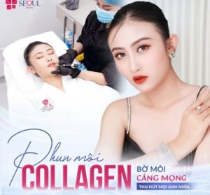 Dịch vụ phun môi collagen tại Seoul Center được khách hàng đánh giá cao