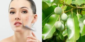 Tìm hiểu chi tiết công dụng của dầu mù u trong lĩnh vực làm đẹp